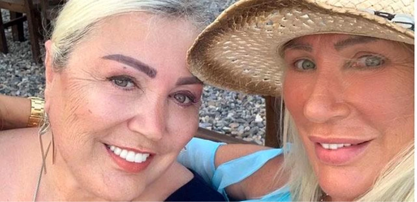 Seda Sayan’ın ablası Nursel Sayan estetik operasyon geçirdi