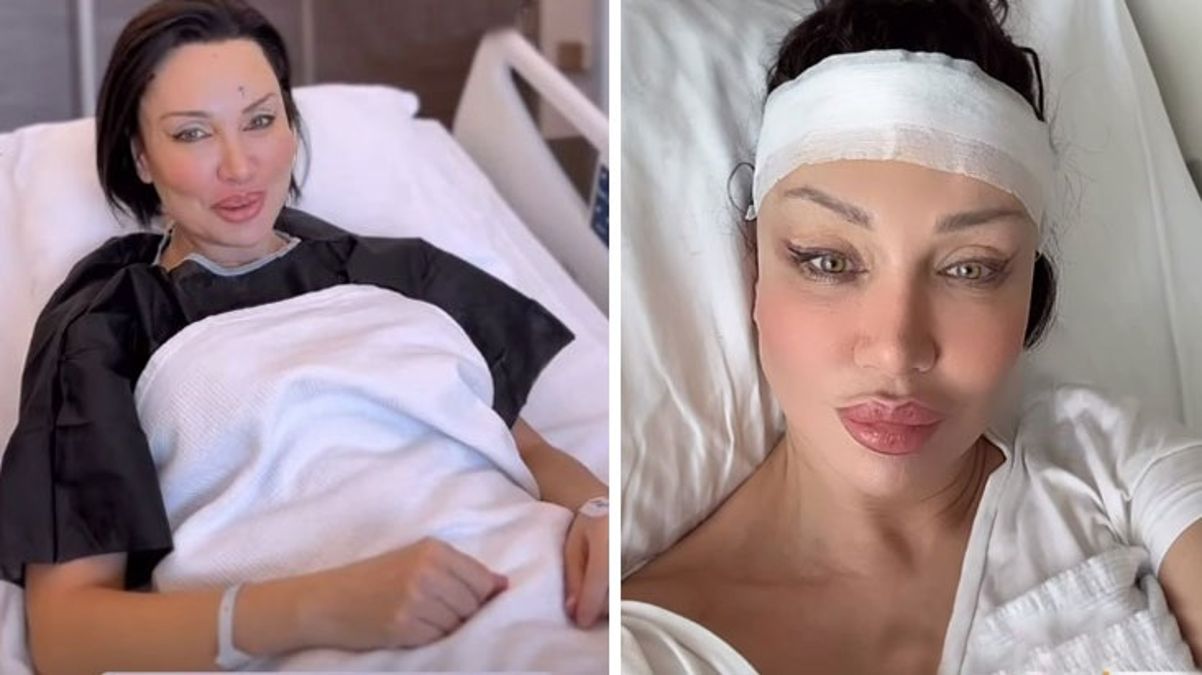 Umut Akyürek, Türkiye’de nadir yapılan alın daraltma operasyonu geçirdi