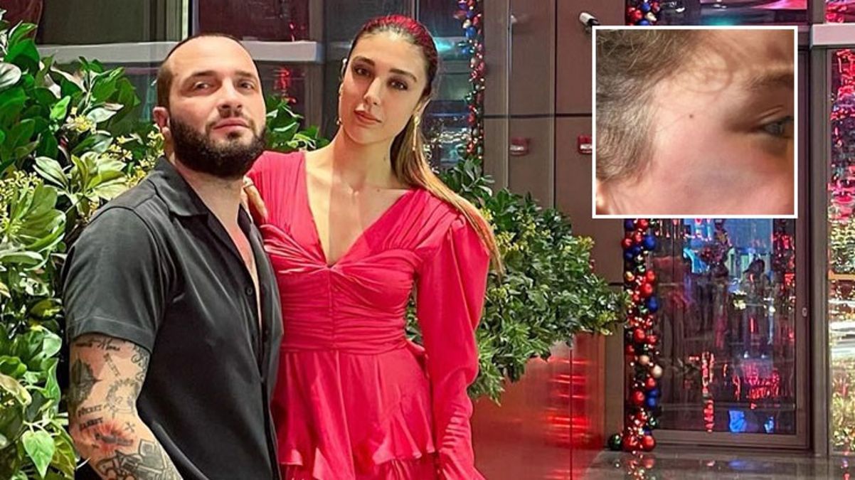 Kızlarının yüzüne mobilya düşmüştü! Berkay’ın eşi duruşmada öfke kustu: Çocuğum travma yaşadı, eşyaları çöpe attım