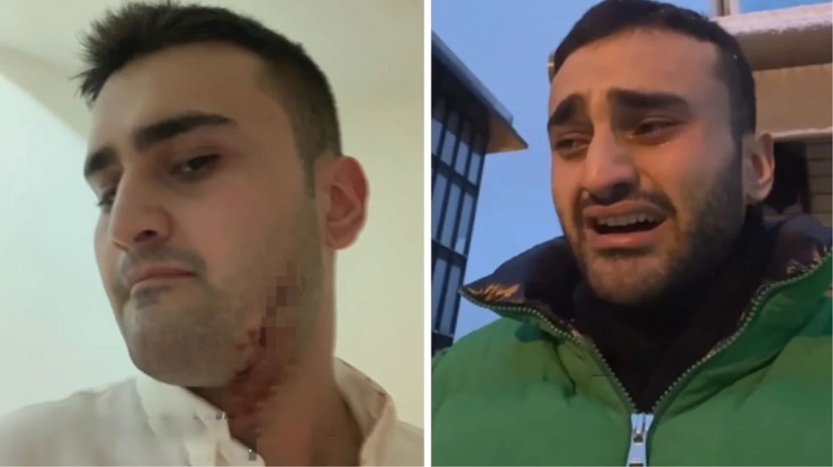 CZN Burak’ın son videosu yara izleriyle gündem oldu