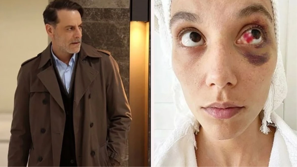 Eski sevgilisini darp ettiği iddiasıyla hapsi istenen Ozan Güven’in davasında Adli Tıp Kurumu raporu hazırlandı