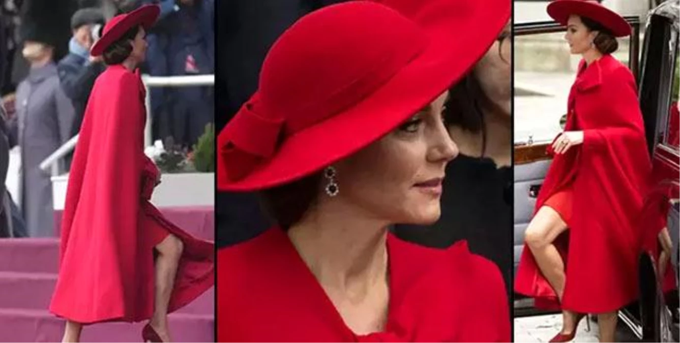 Prenses Kate Middleton Karın Ameliyatı Geçirdi, 14 Gün Hastanede Kalacak