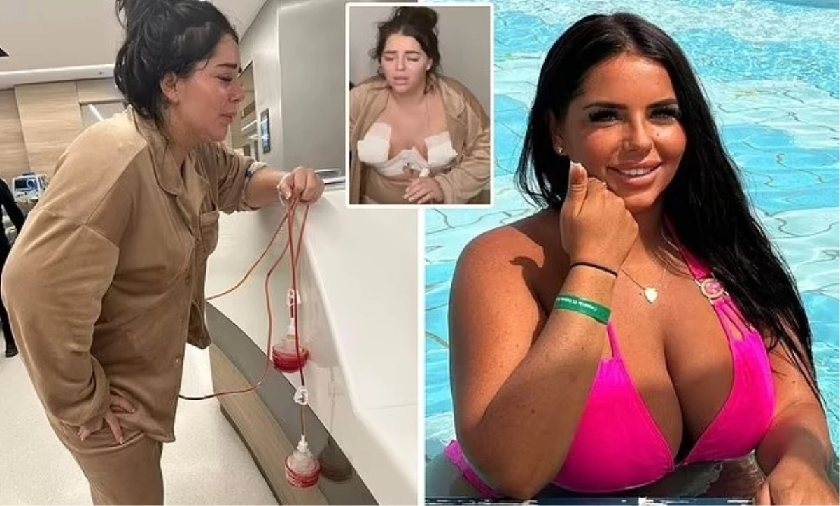 İngiliz Model Chloe Rose, Göğüs Estetik Ameliyatı Sonrası Göğüs Uçlarının Çürümeye Başladığını İddia Etti