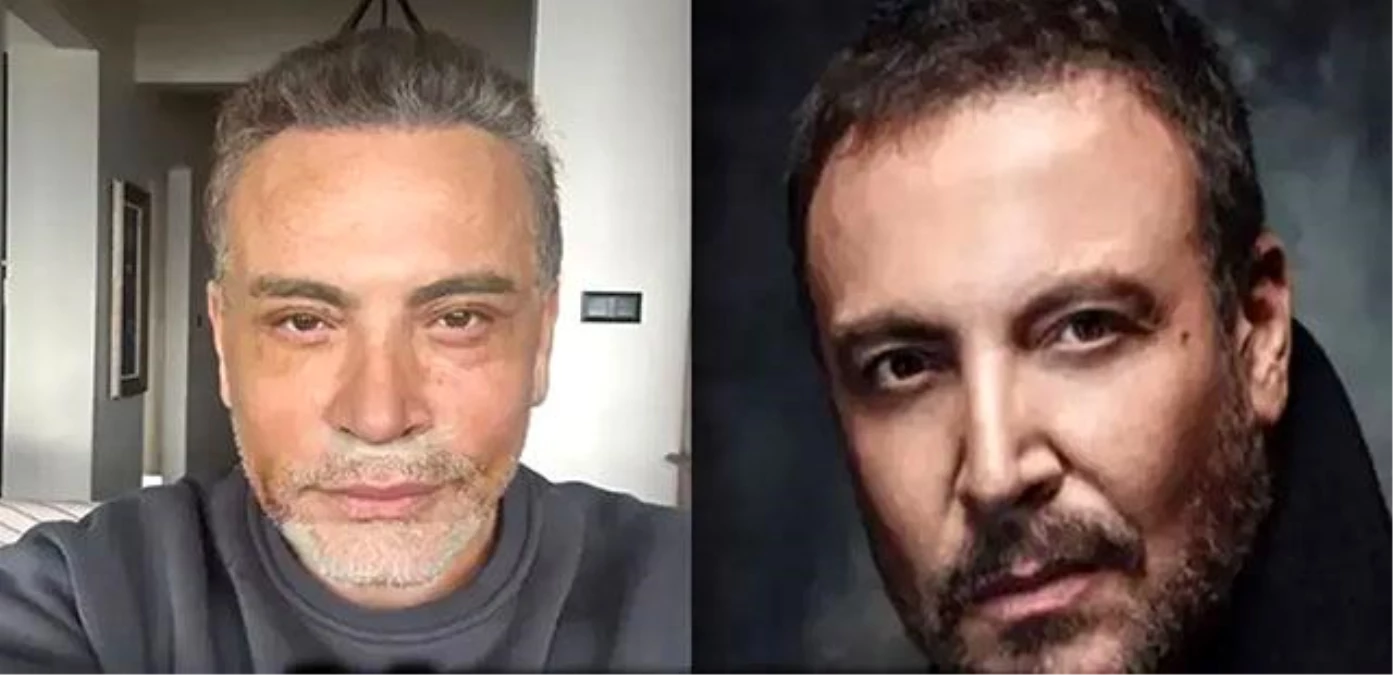 Cenk Eren Estetikli Ünlüler Kervanına Katıldı