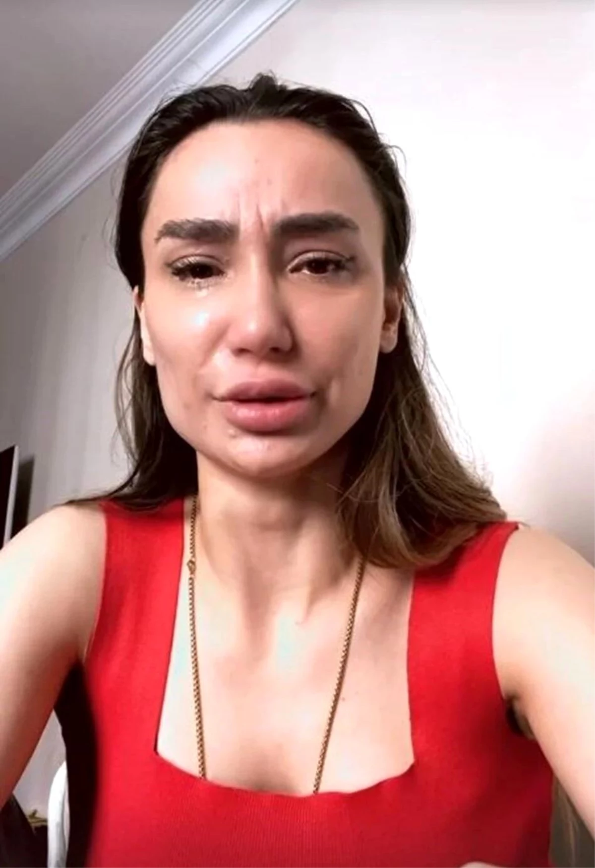 Emre Aşık’ın eski eşi Yağmur Sarnıç intihara kalkıştı