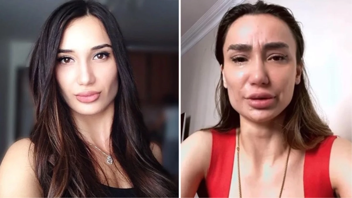 Emre Aşık’ın eski eşi Yağmur Sarnıç intihara kalkıştı