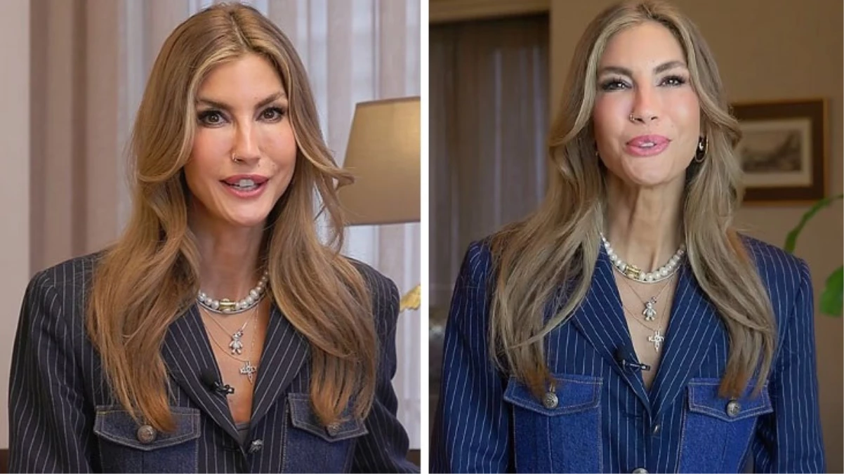 Estetiğin dozunu kaçıran Çağla Şıkel’in son hali alay konusu oldu