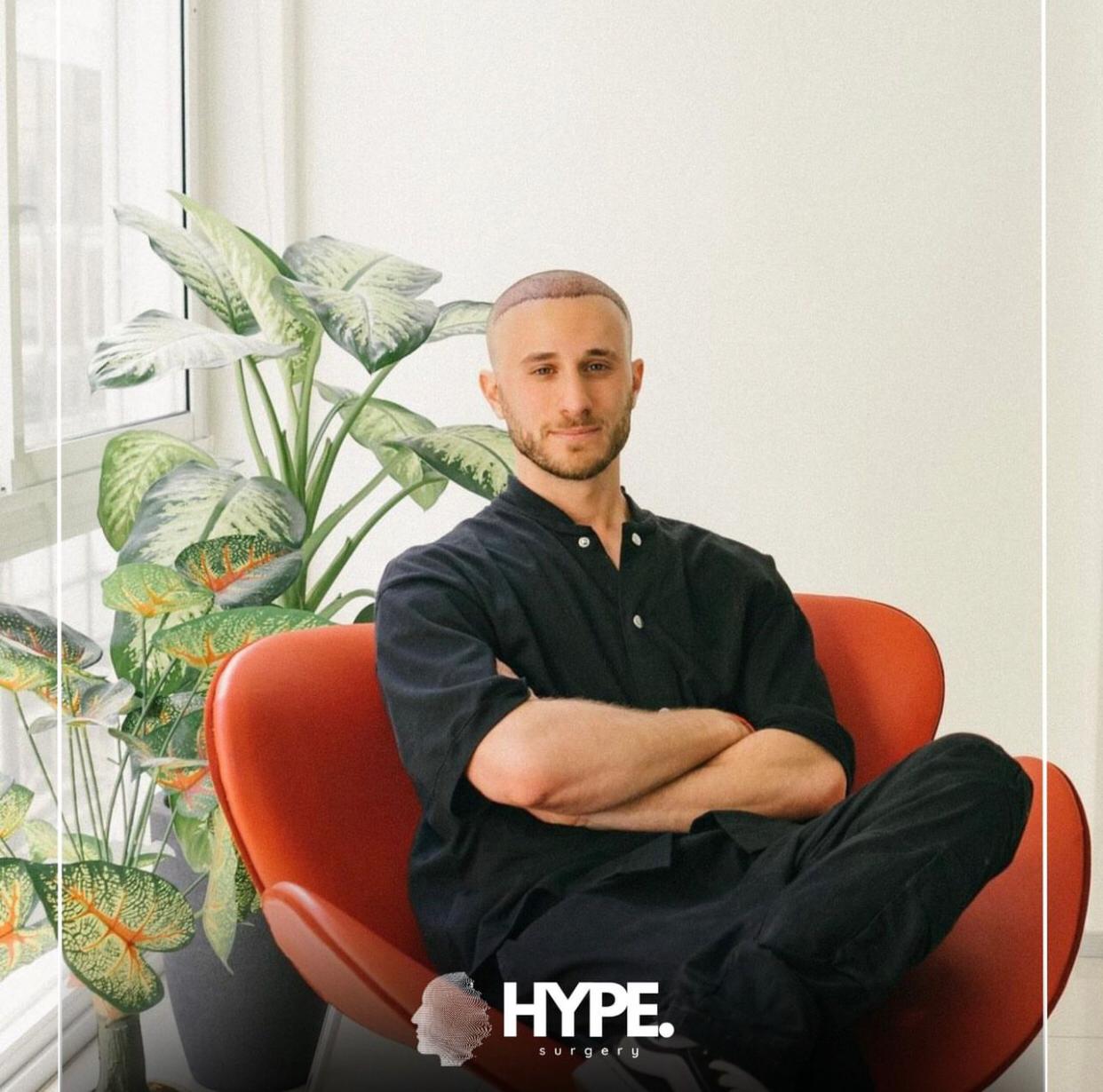 Hype Surgery Saç Ekimi Merkezi: Tıraşsız Saç Ekimi ile Konforlu ve Doğal Sonuçlar