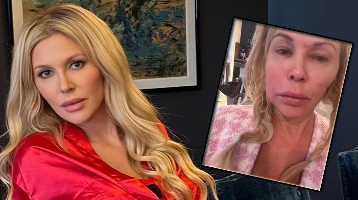 Brandi Glanville Yıllardır Süren Sağlık Sorununa Nihayet Tanı Koyulduğunu Açıkladı