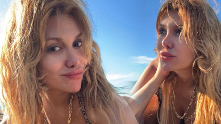 Survivor Almeda Baylan’ı Görenler Tanıyamadı: 29 Kilo Verip Yenilendi!