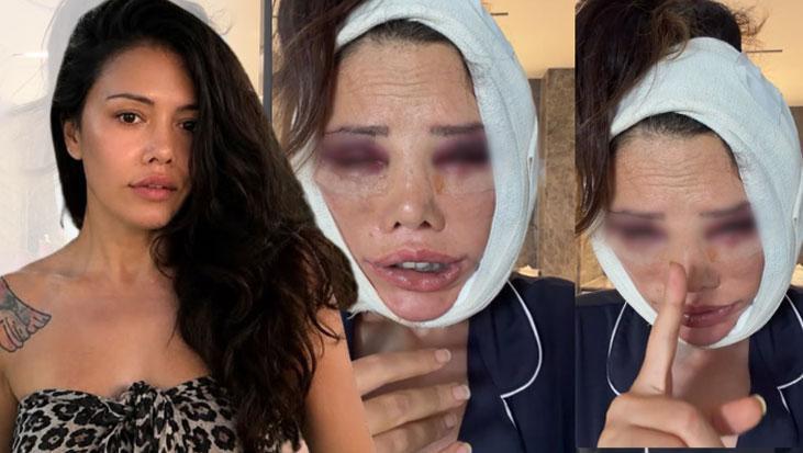 Didem Ceran’dan Hukuki Adım: Güney Kore’deki Estetik Operasyonunda “Sözleşme” Krizi