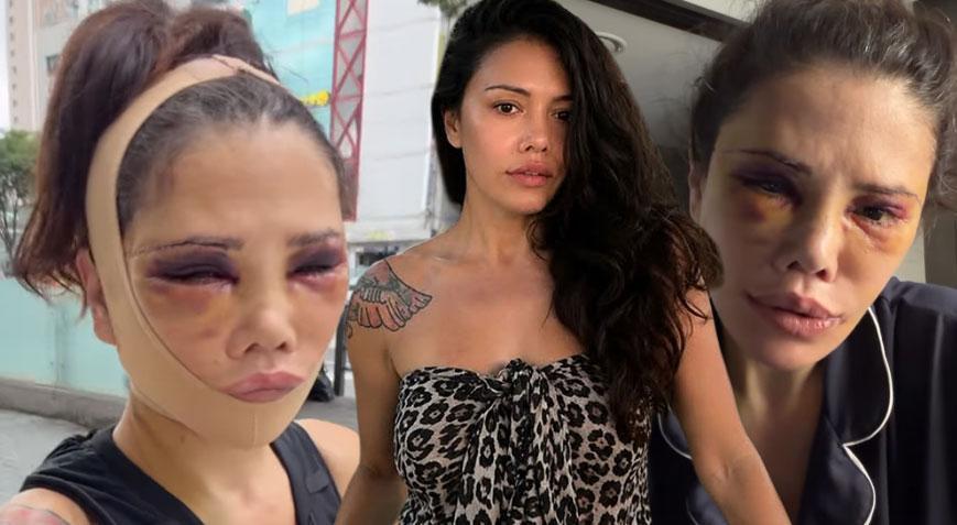 Didem Ceran Gözyaşları İçinde Konuştu: “Yeniden Ameliyat Olacağım”