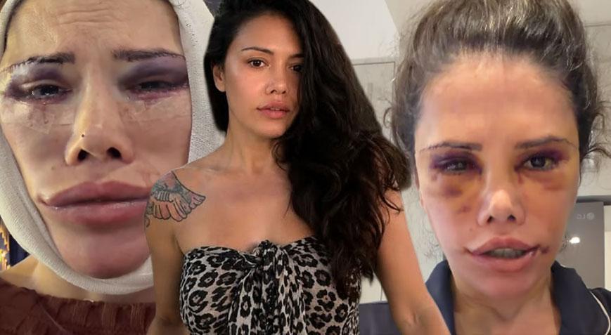 Didem Ceran’dan Güney Kore’deki ameliyat sürecine ilişkin açıklama