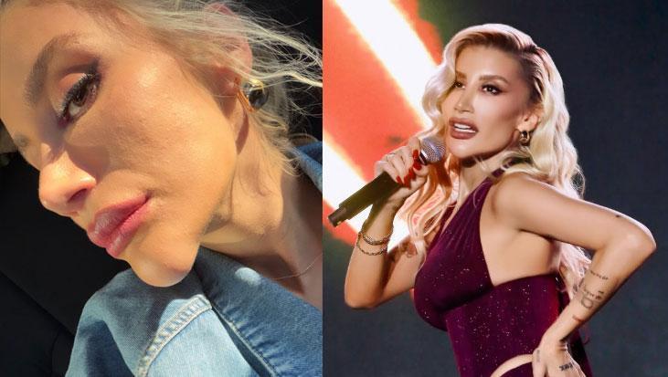 İrem Derici, çenesindeki şişliğin nedenini açıkladı