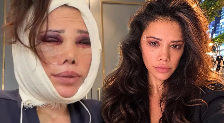 Didem Ceran bu kez ‘Kim Kardashian estetiği’ yaptıracak