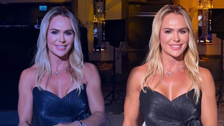Survivor’ın Nagihan’ı değişimiyle gündemde! Estetik masrafını açıkladı